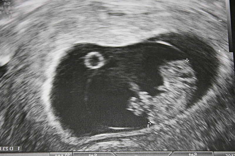 Primo trimestre sintomi paure rischi gravidanza feto libricino-libri-fiabe-favole-per-bambini-ragazzi-news-blog-recensioni (2)